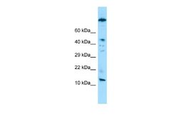 VCY Rabbit anti-Human, Polyclonal, Novus Biologicals 0.1ml; Unconjugated:Antibodies,
